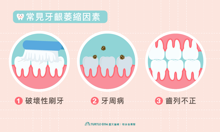 圖解牙齦萎縮三大原因：牙周病、錯誤刷牙方式、牙齒排列不整
