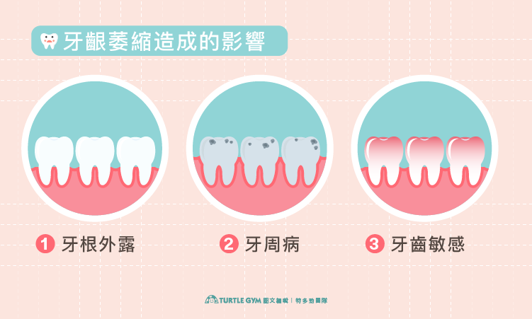 牙齦萎縮的影響，包含牙齒敏感和蛀牙風險增加